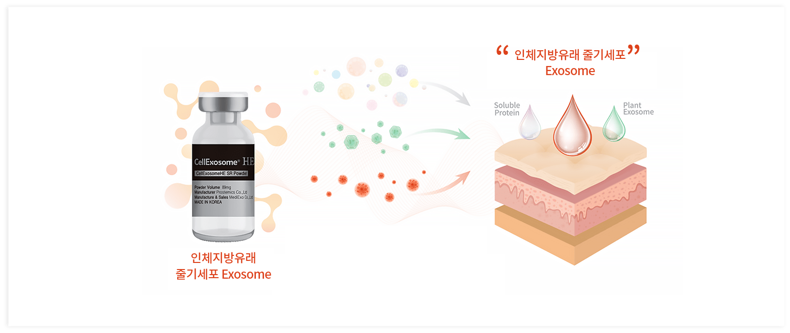 인체지방유래 줄기세포 exosome