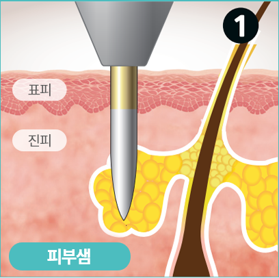 표피, 진피, 피부샘